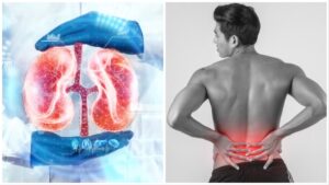 Demerits of Fox Nuts