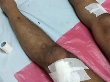 whatsapp image 2025 03 15 at 053904 1 1741998239