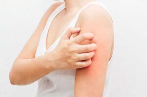 Skin Cancer Symptoms