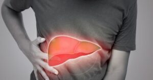 Fatty Liver Symptoms: हैदराबाद के 84% IT प्रोफेशनल्स हुए फैटी लिवर के शिकार! जानिए कैसे करें इससे बचाव 4 Fatty Liver Symptoms