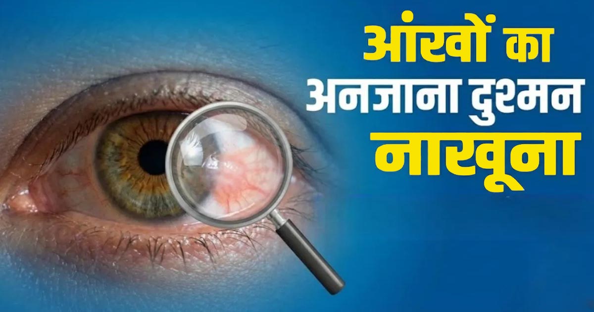 Pterygium eye disease symptoms