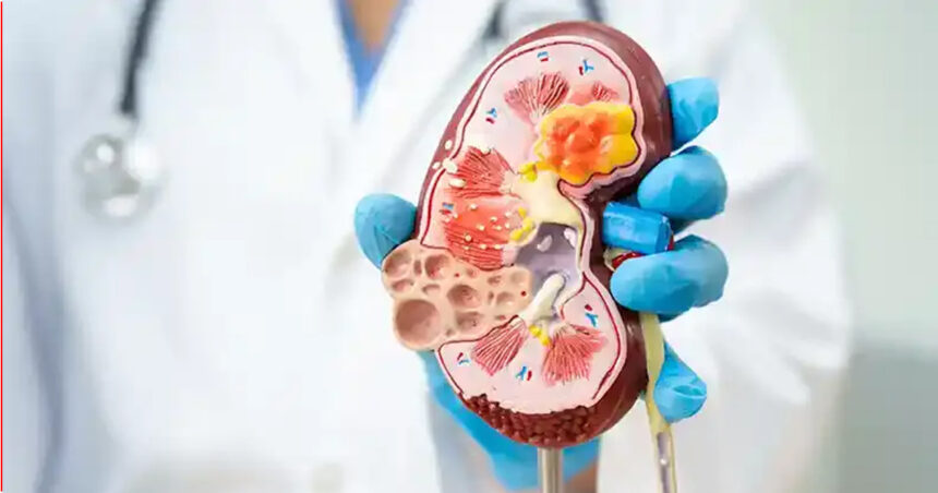 Silent Kidney Disease
