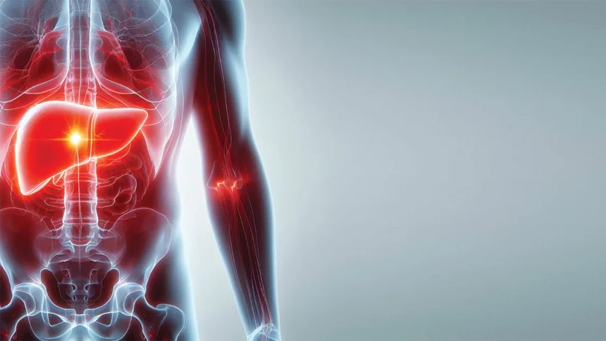 Liver Disease Crisis